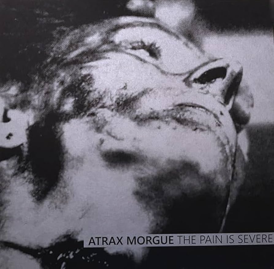 【新品未使用】Atrax Morgue The Pain Is Severe Pain Is Severe : Atrax Morgue: Amazon.es: CD y vinilos}