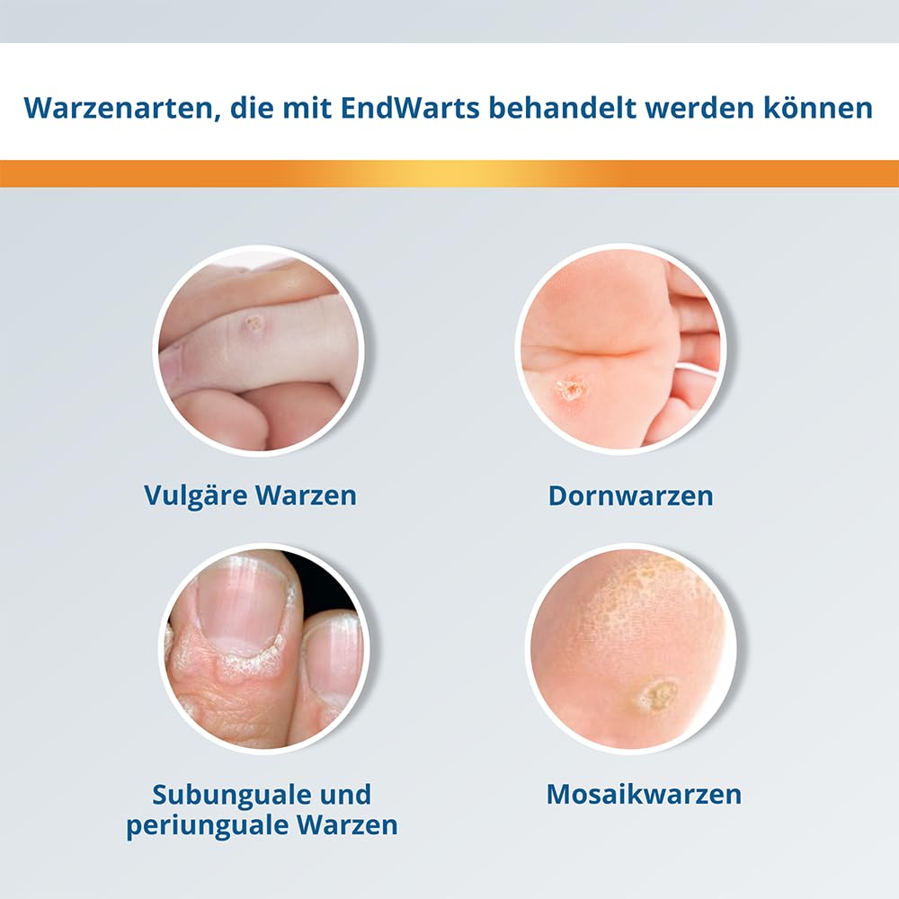 EndWarts FREEZE: Warzen & Dornwarzen behandeln, Vereisungsmittel zur Behandlung von Stielwarzen an Händen, Armen & Füßen, 7-Einweg-Spitzen