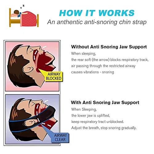 Anti Schnarchen Kinnriemen, 2025 Aktualisierung Schnarchstopper Schnarchlösung Anti Schnarchen Kinnriemen, Professionell Wirksam Hilft Gegen Schnarchen Schnarchgerät Zur Schnarchreduzierung