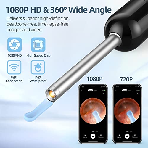 Ear Wax Removal, FSA HSA Eligible, Ear Cleaner with Camera with 1080P, Otoscope with Light, Ear Wax Removal Kit with 6 Ear Pick, Ear Camera for iPhone, iPad, Android Phones - Image 3