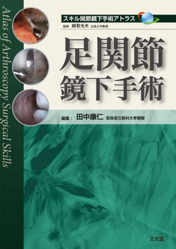 無料電子書籍 pdf 足関節鏡下手術 (スキル関節鏡下手術アトラス) バイ