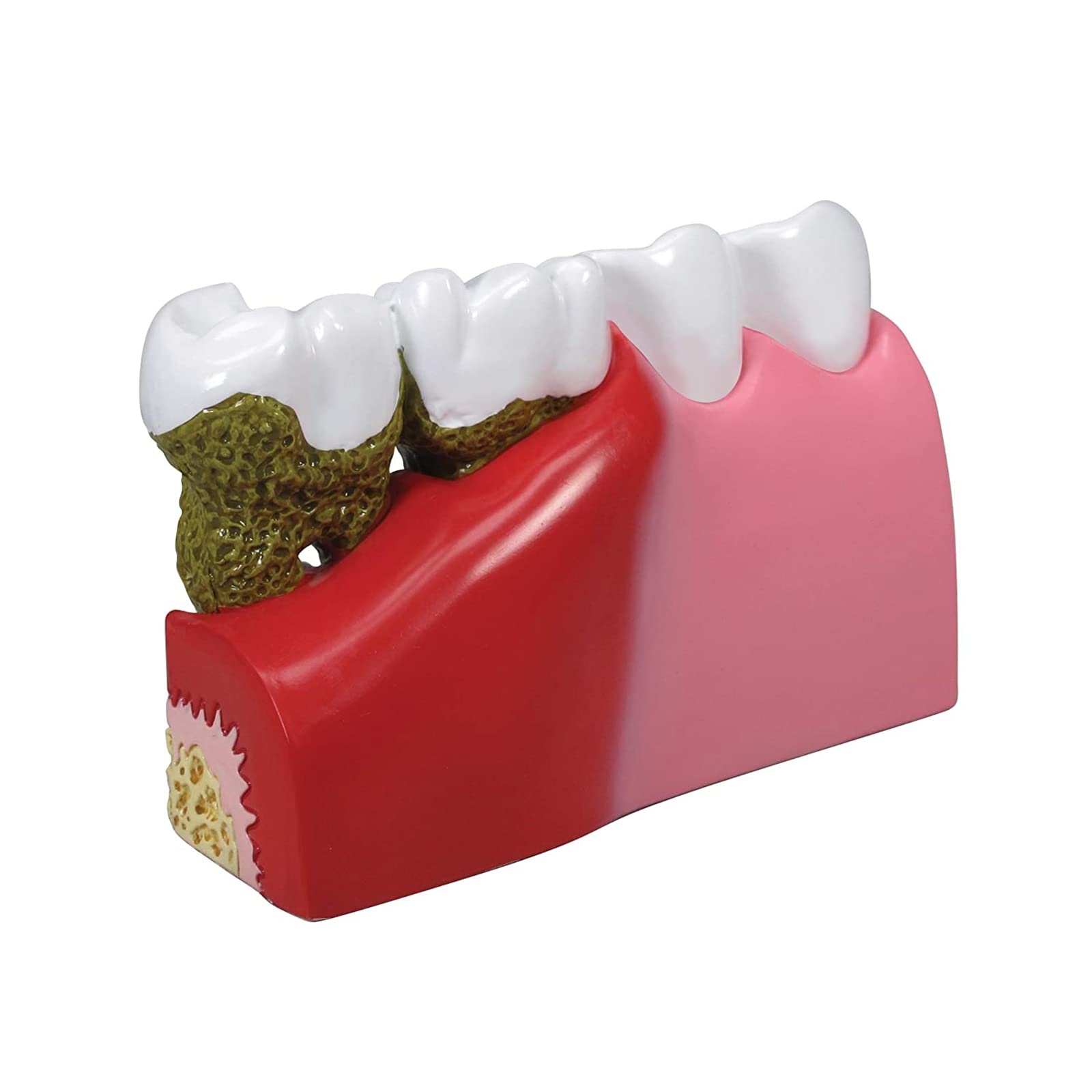 Dentalmodell, Anatomie des menschlichen Körpers, Nachbildung von Zähnen mit/häufigen Pathologien, für die Zahnarztpraxis, Lehrmittel, Anatomicals