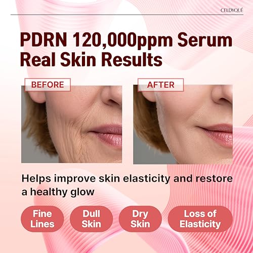Image of Salmon DNA PDRN 120,000 ppm EGF Peptide Microneedling Serum w /Volufiline, Phyto PDRN 12%, Growth Factor - Anti-Aging Face Serum with Niacinamide, Hyaluronic Acid 1 Fl Oz Korean Skincare