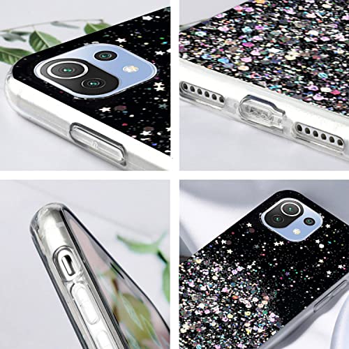 Per Cover Xiaomi 11 Lite 5g NE Glitter Rosa Cover