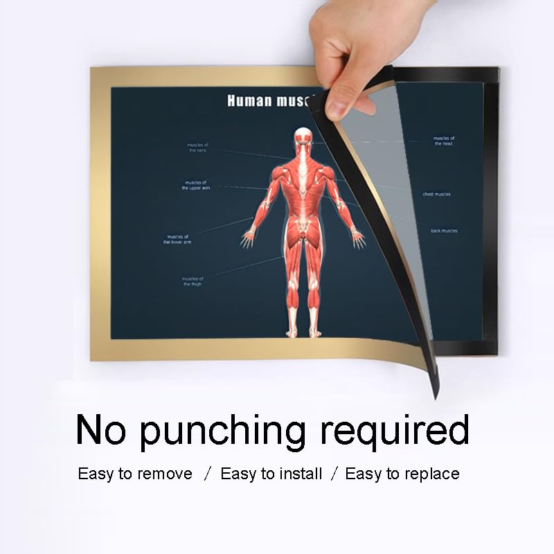 Image of Taanfu Body Educational Learning Anatomy Posters ，Muscle Tissue Art Muscle Villi Anatomy Art Poster Digestive System Organs Illustration Small Intestine Physiology Anatomy Wall Art Villi