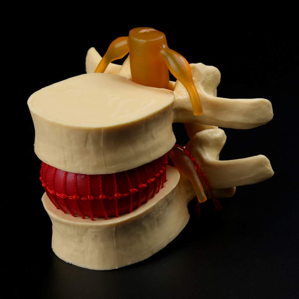 Anatomia Człowieka, Kręgosłup, Przepuklina Kręgosłupa Lędźwiowego, Tryb Nauczania, Czaszka, Uraz, Sprzęt Szkolny, Tryb Nauczania