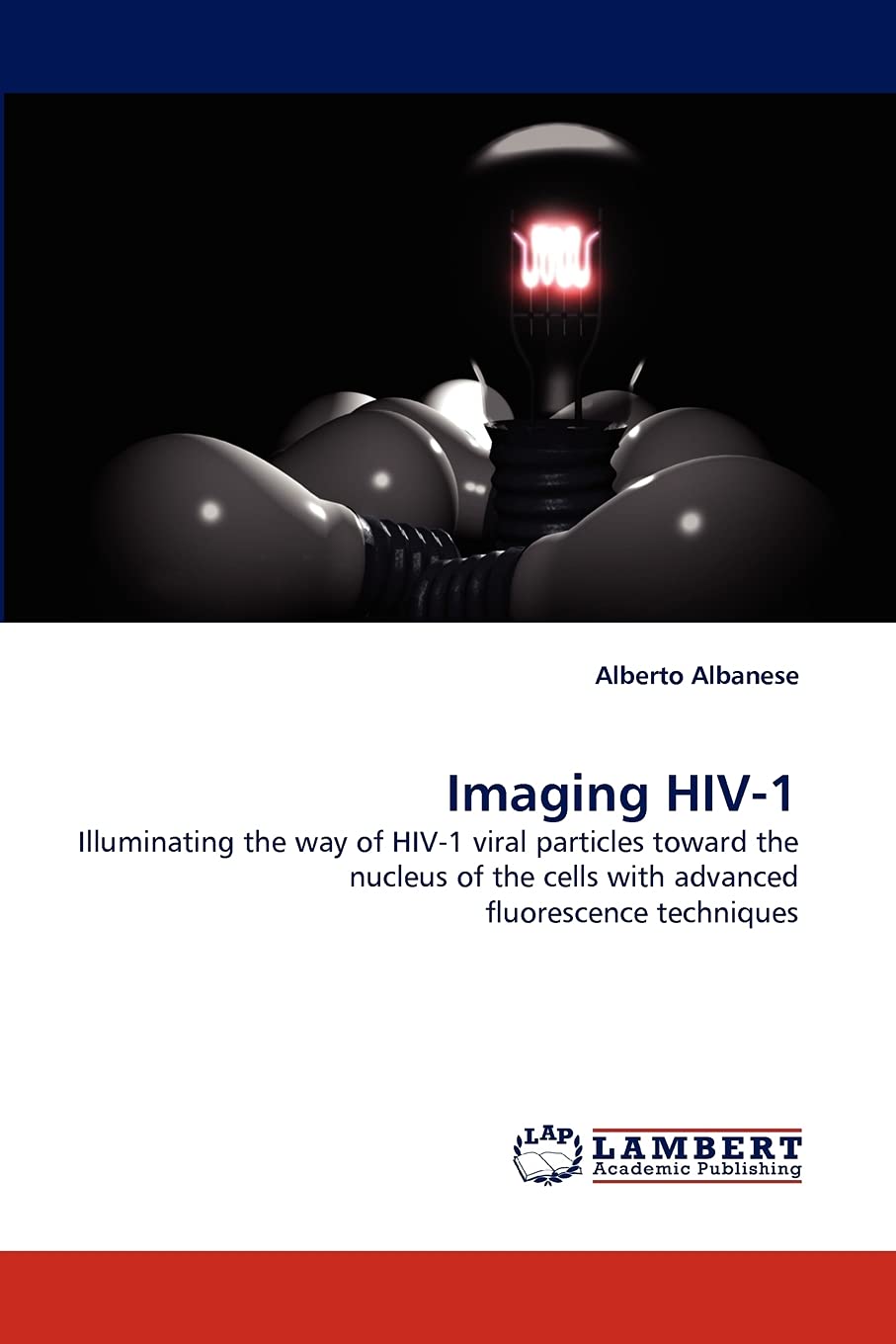 Imaging HIV-1: Illuminating the way of HIV-1 viral particles toward the nucleus of the cells with advanced fluorescence techniques