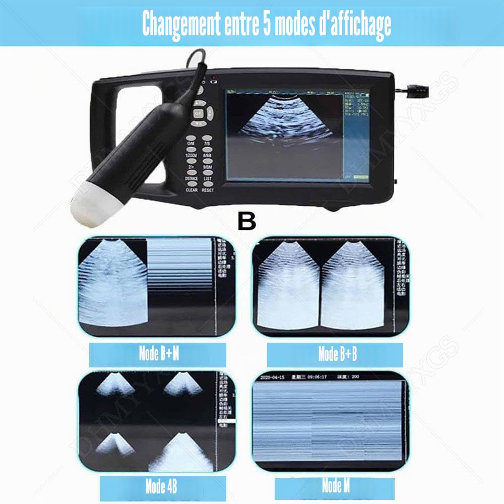 ÉChographe VéTéRinaire pour Diagnostic Gestation,ÉChographe B pour Animaux,Vet Digital Portable B-Ultra,avec Sonde MéCanique 3,5 MHz,pour Ovins,Chiens,Chats Et Porcs.Test