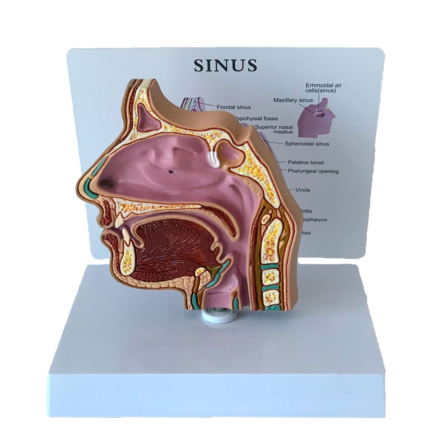 Tonsillar Sinus tonsillar-sinus