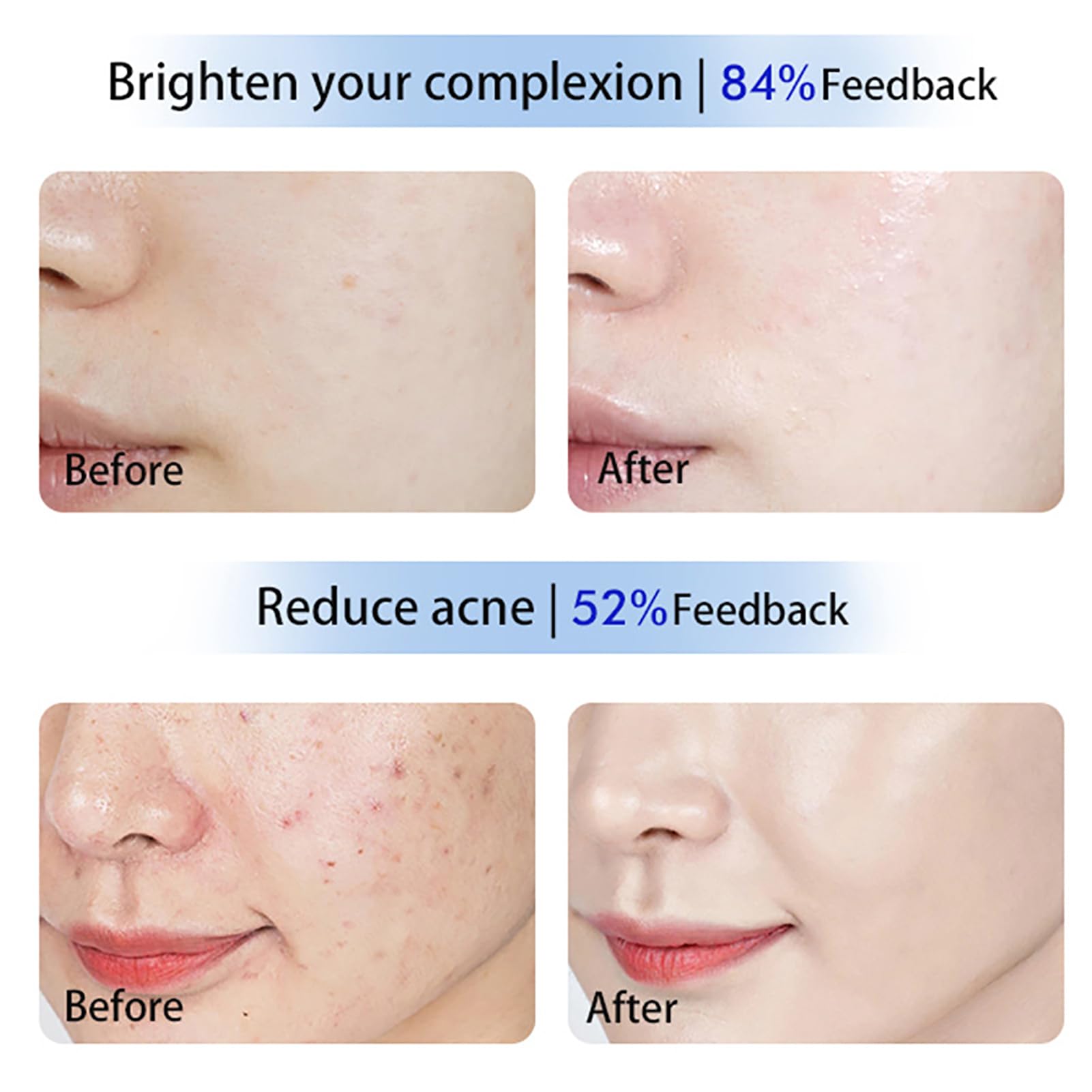 GOURIXIN Terapia de luz roja Facial con diseño de Espejo, Dispositivos de Terapia de luz infrarroja de 460 NM, 590 NM, 640 NM y 950 NM, para aliviar la Fatiga Muscular