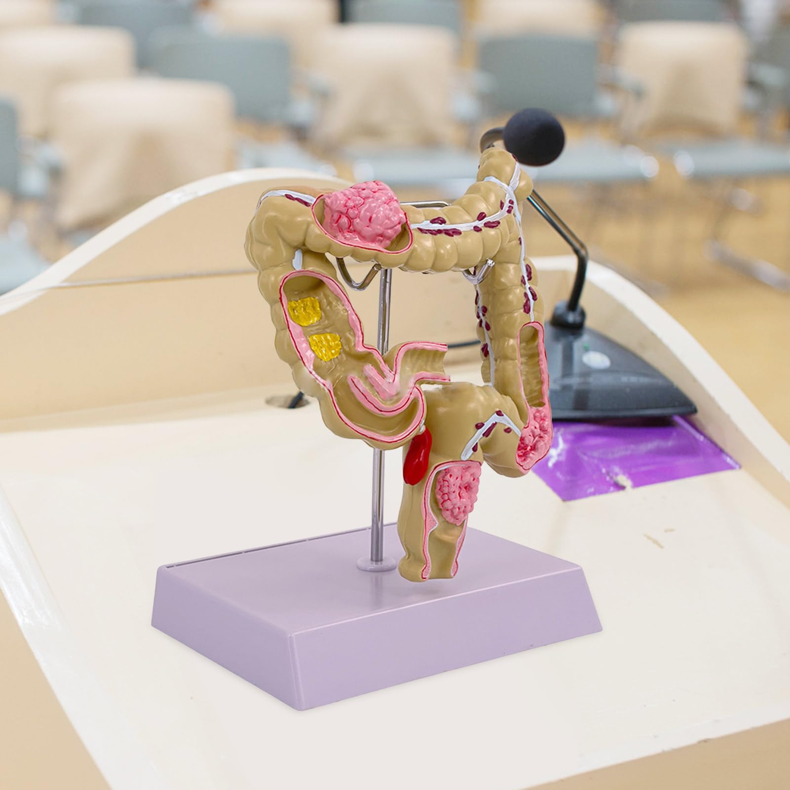 Modello umano dell'intestino crasso Patologie umane del modello dell'intestino crasso Strumento didattico per studi scolastici di laboratorio Patologie del modello dell'intestino crasso Modello di