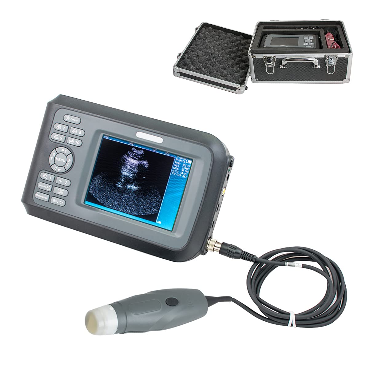 Lolicute Veterinary Digital Scanner Portable Laptop Scanner, Farm Animals Pet Handheld Scanner with 