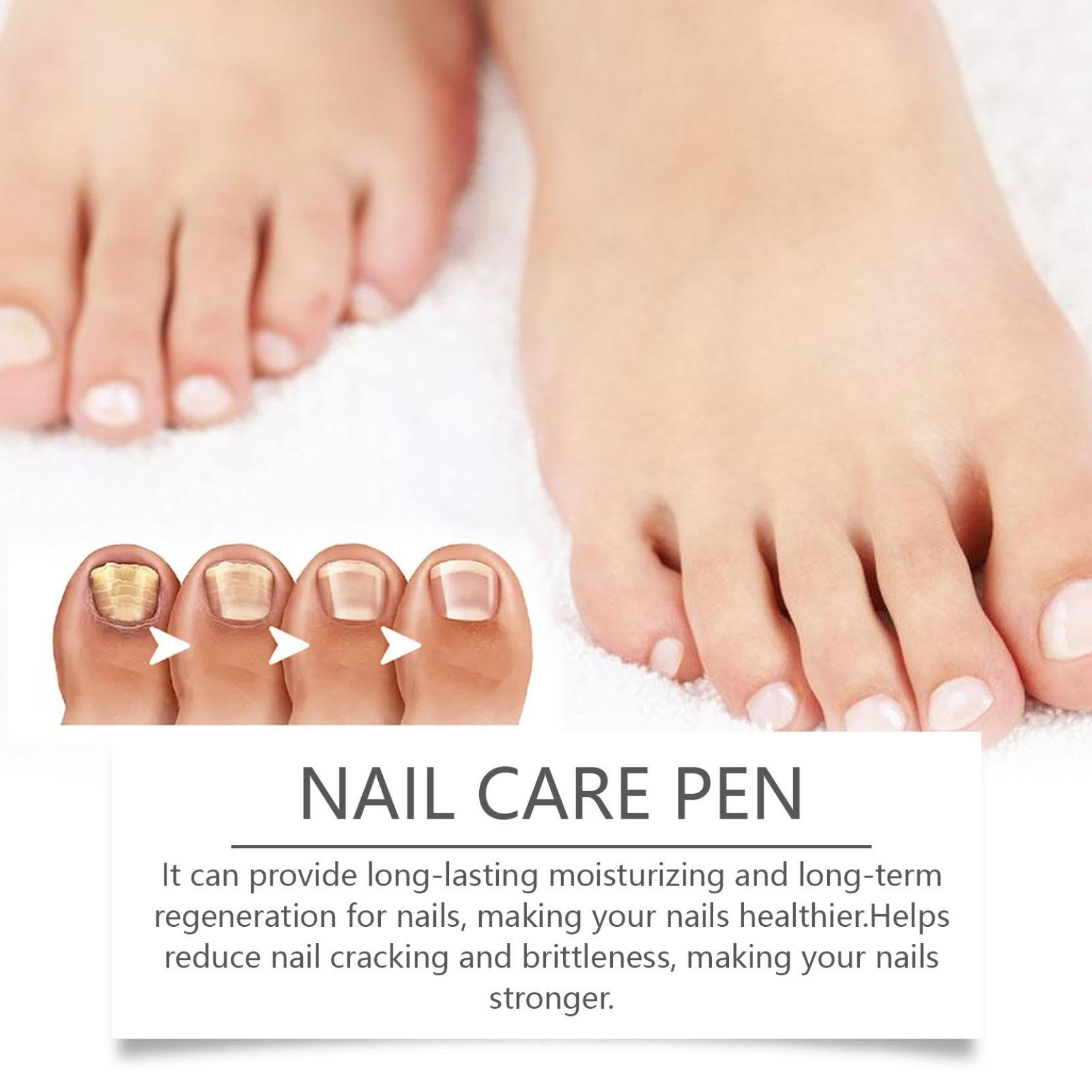 Nail Care Pen - Das Original, Nagelpilz Stift Österreich, Nail Care Pen Kosmetische Pflege Bei Nagelpilzinfektion, Mit Teebaumöl & Aloe Vera (5)