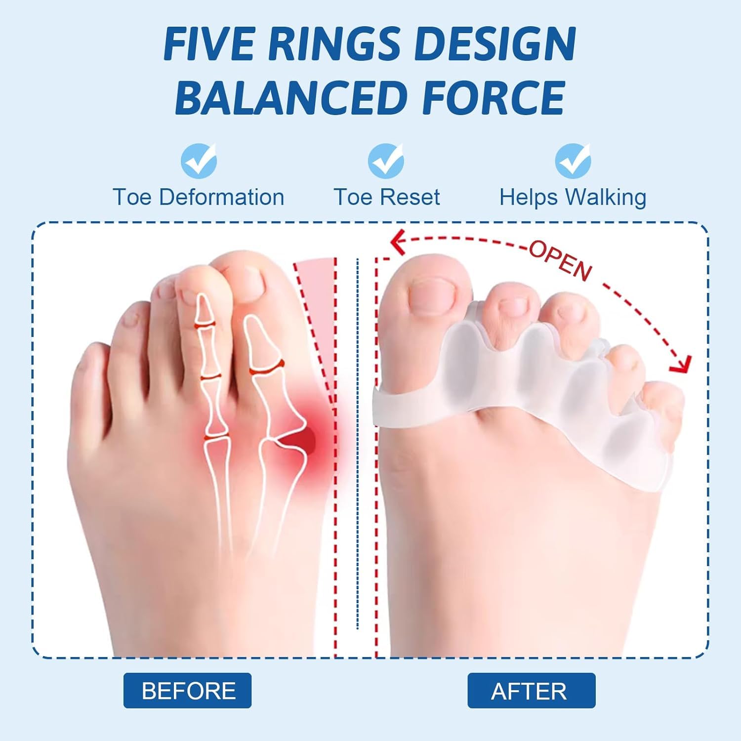Separador Dedos Pie Silicona Corrector Dedos Pies Alivia Dolor Estres Dedo Martillo Hallux Valgus 4 Piezas
