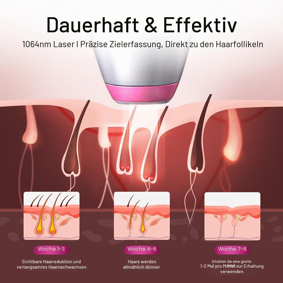 DermRays 1064 nm Diodenlaser-Haarentfernung für Hauttöne 1-6, Eiskühlung, Gesicht, Körper