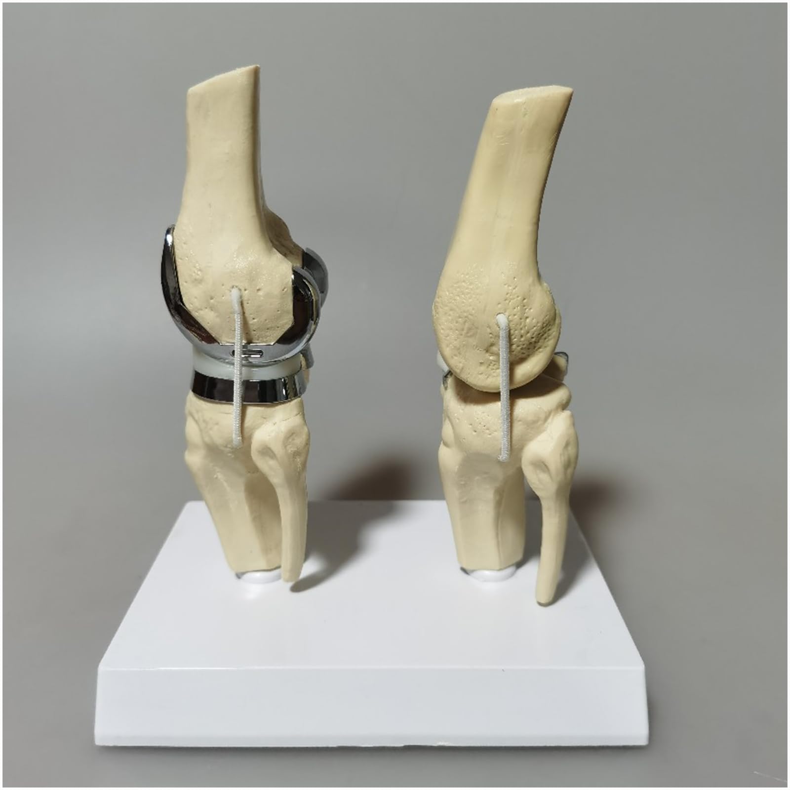 Modello di Protesi articolare del Ginocchio con cartilagine Artificiale Modello di Protesi per Chirurgo Ortopedico clinico Modello di Comunicazione con Il paziente,Bianca,20cm