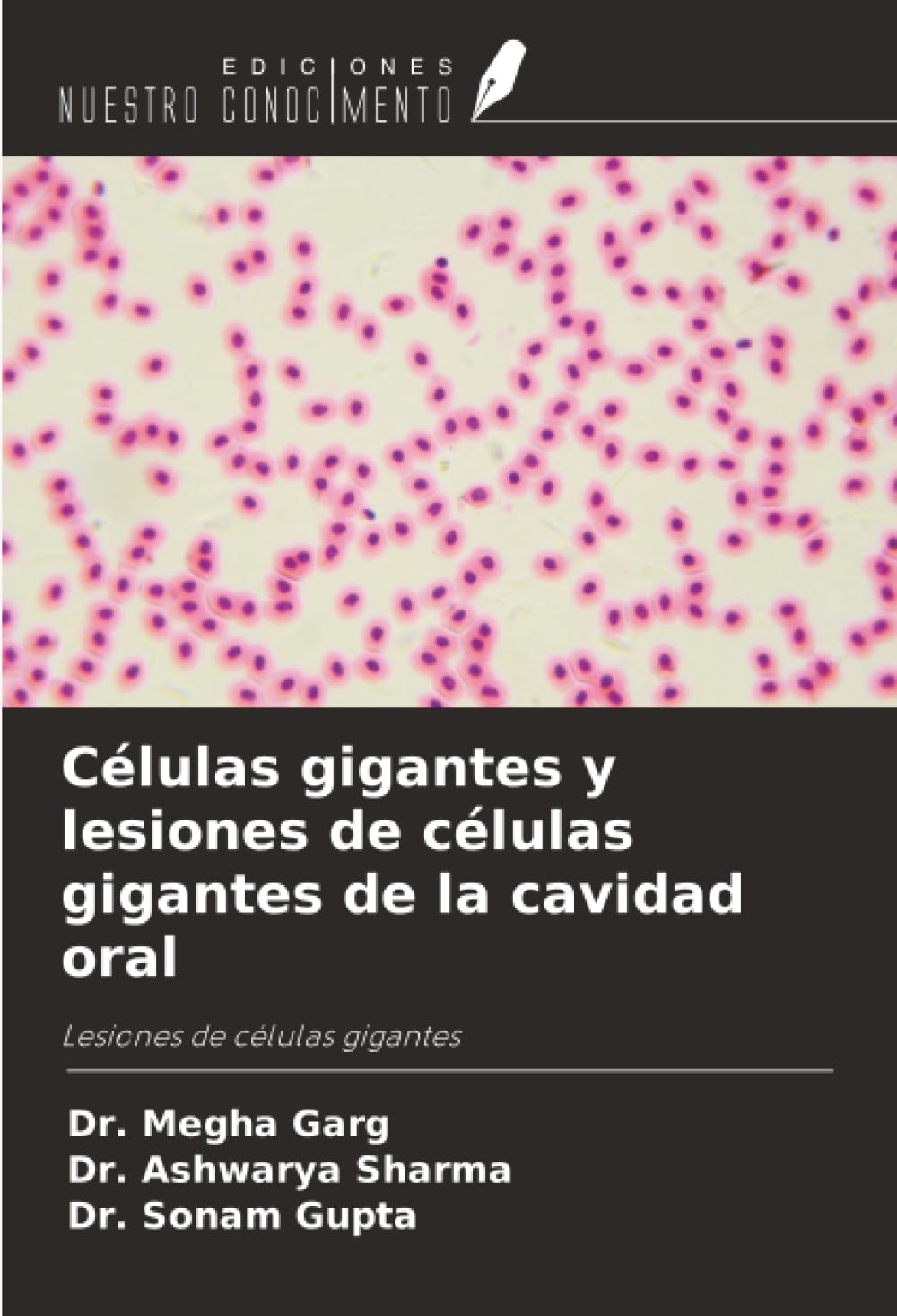 Células gigantes y lesiones de células gigantes de la cavidad oral: Lesiones de células gigantes