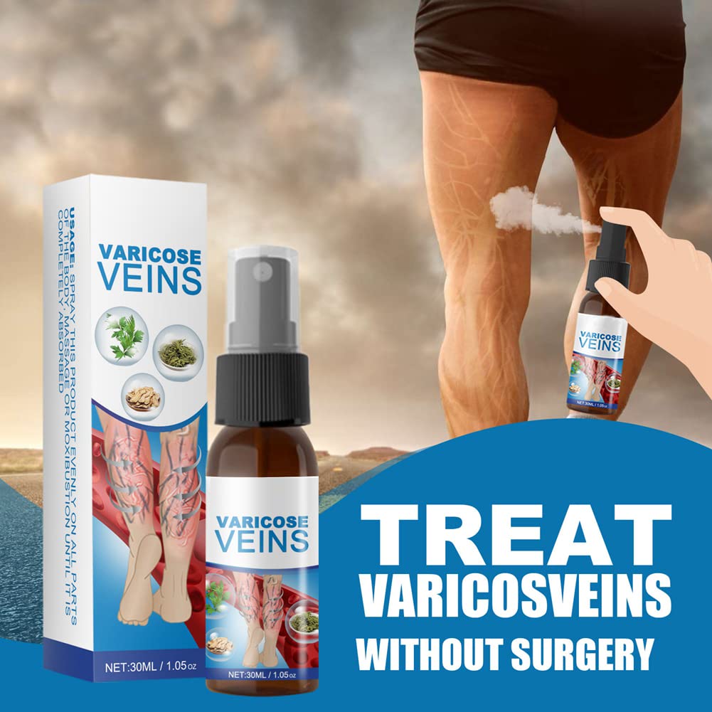 Spray Calmante para Venas Varicosas, Varices Venas Milagrosa Spray, Spray para Tratamiento de Venas Varicosas, Pierna de Alivio Dolor, Mejora La Circulación Sanguínea