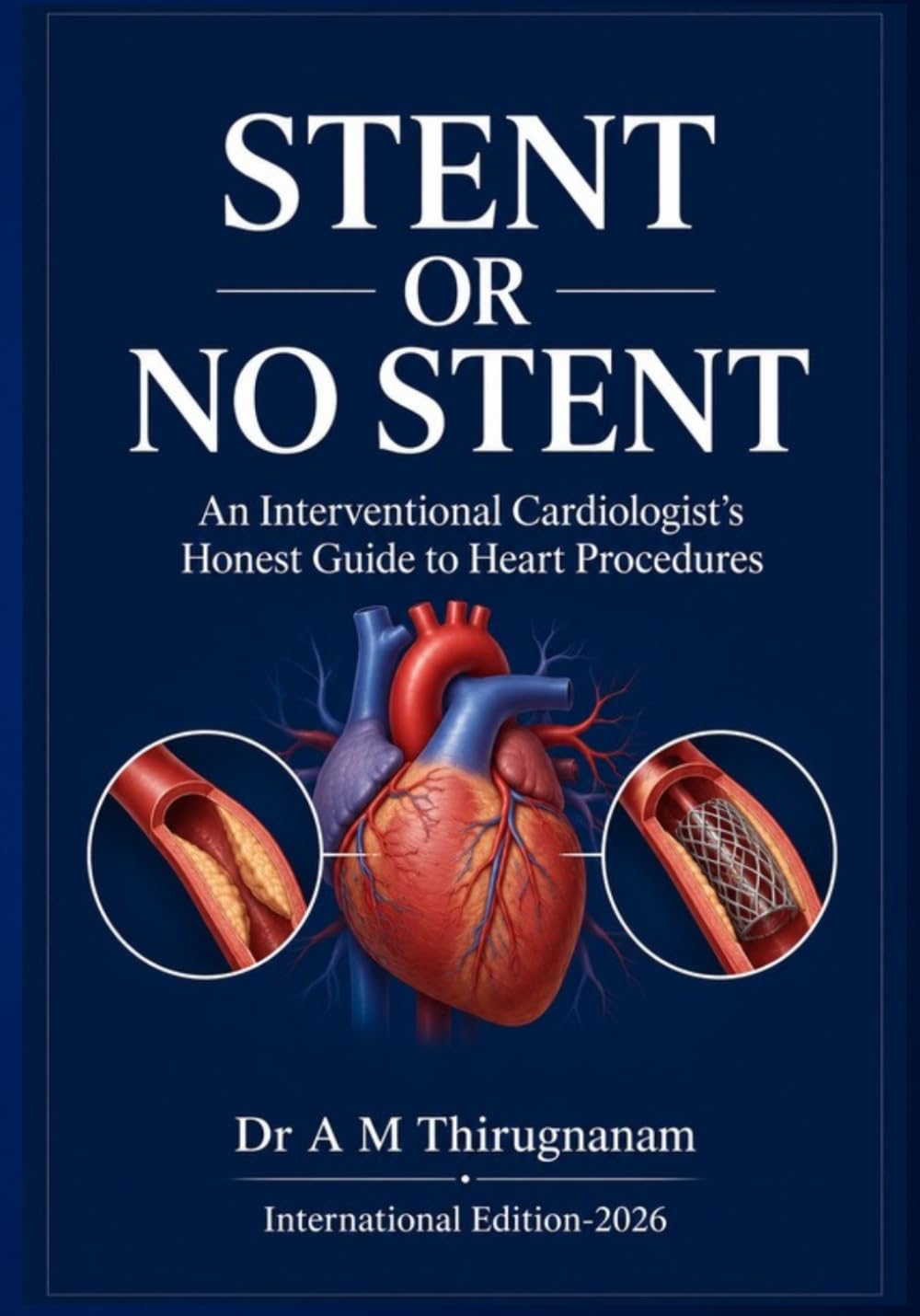 STENT OR NO STENT - An Interventional Cardiologist’s Honest Guide to Heart Procedures (Preventive Cardiology Series)