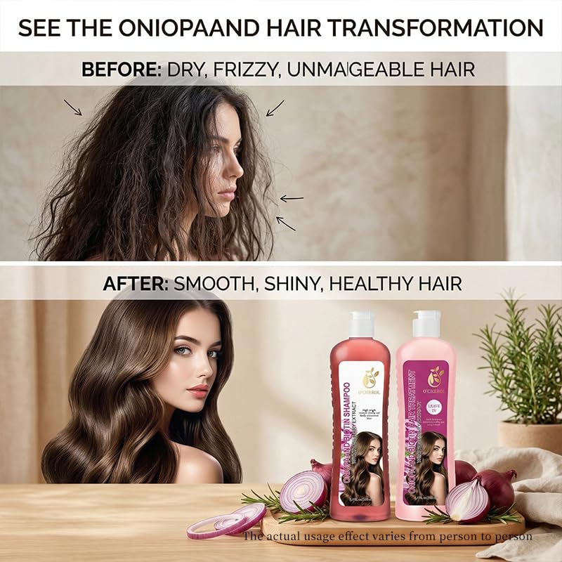 O'CHEROL Onion Hydrosol Shampoo with Biotin & Rosemary Shampoo and Conditioner Set for Hair Growth, Natural Organic Hydrating Moisturizing Formula for Dry Hair, Oil Control, Plump & Fluffy Volume