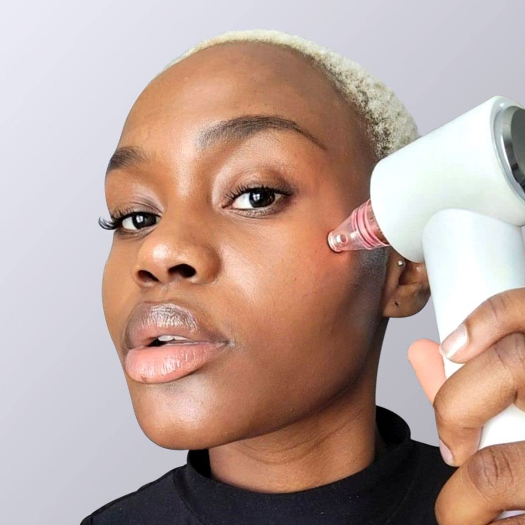 Aspiratore Punti Neri Vacuum Ricaricabile, 4-in-1 - Professionale Comedone Estrattore Elettrico, Rimozione di Punti Neri, Acne, Brufoli con impacco caldo/freddo e fototerapia - Clara (Bianco)