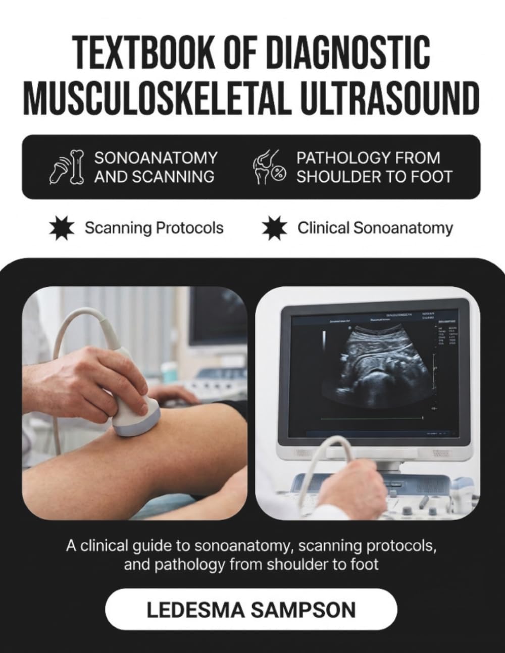 Textbook of Diagnostic Musculoskeletal Ultrasound: A Clinical Guide to Sonoanatomy, Scanning Protocols, and Pathology from Shoulder to Foot