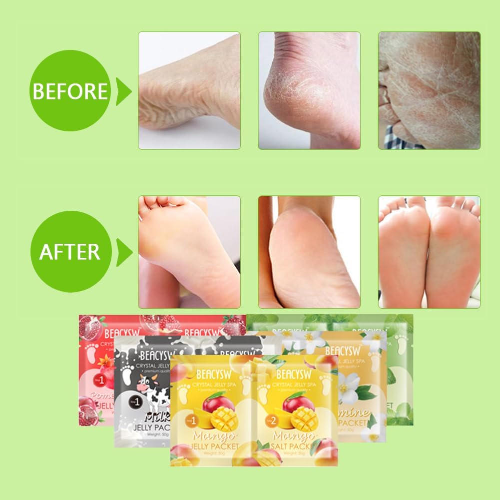 5 PCS Jelly Pedicure Foot Soak Packets Foot Soak Salts For Feet Tired Foot Odor Nail Discoloration Feet Softens Calluses Pedicure Foot Gel
