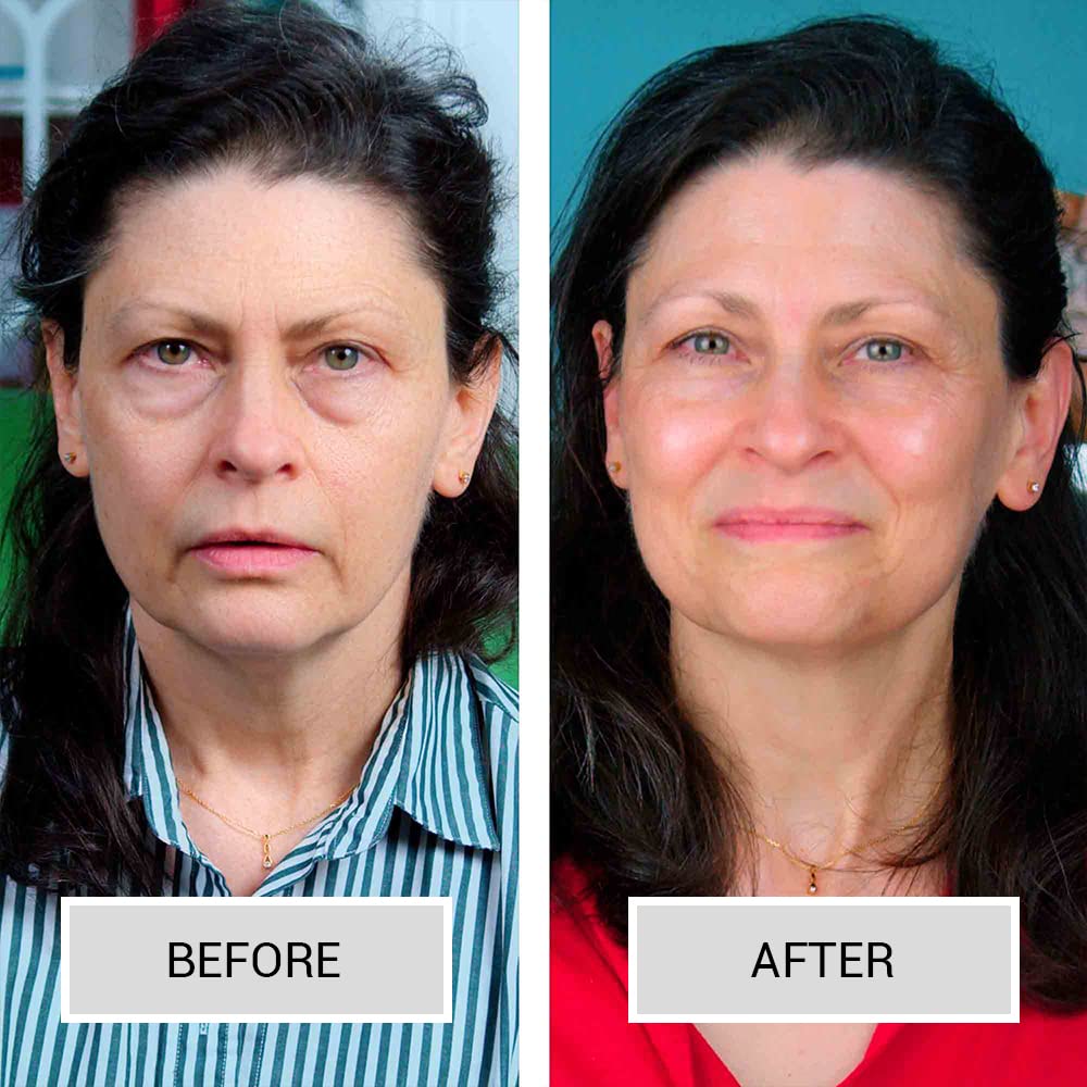 Open Formula Vitamin C 15 Solution Brightens Smooths Wrinkles & Dark