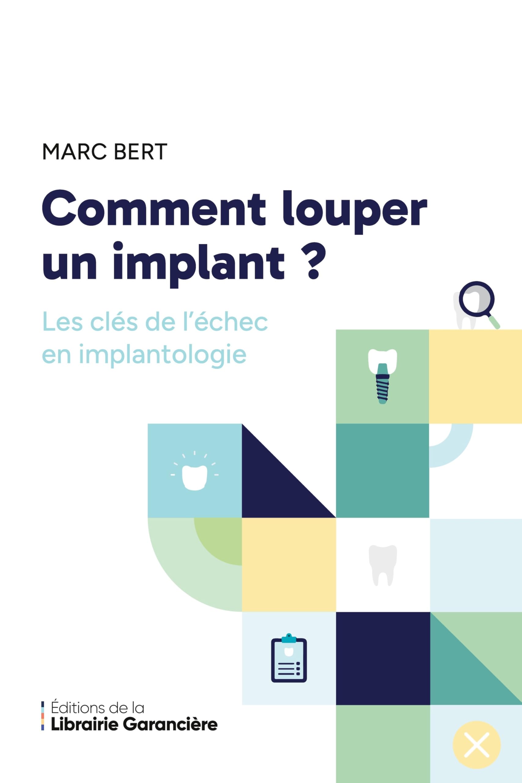 Comment louper un implant: Les clés de l'échec en implantologie