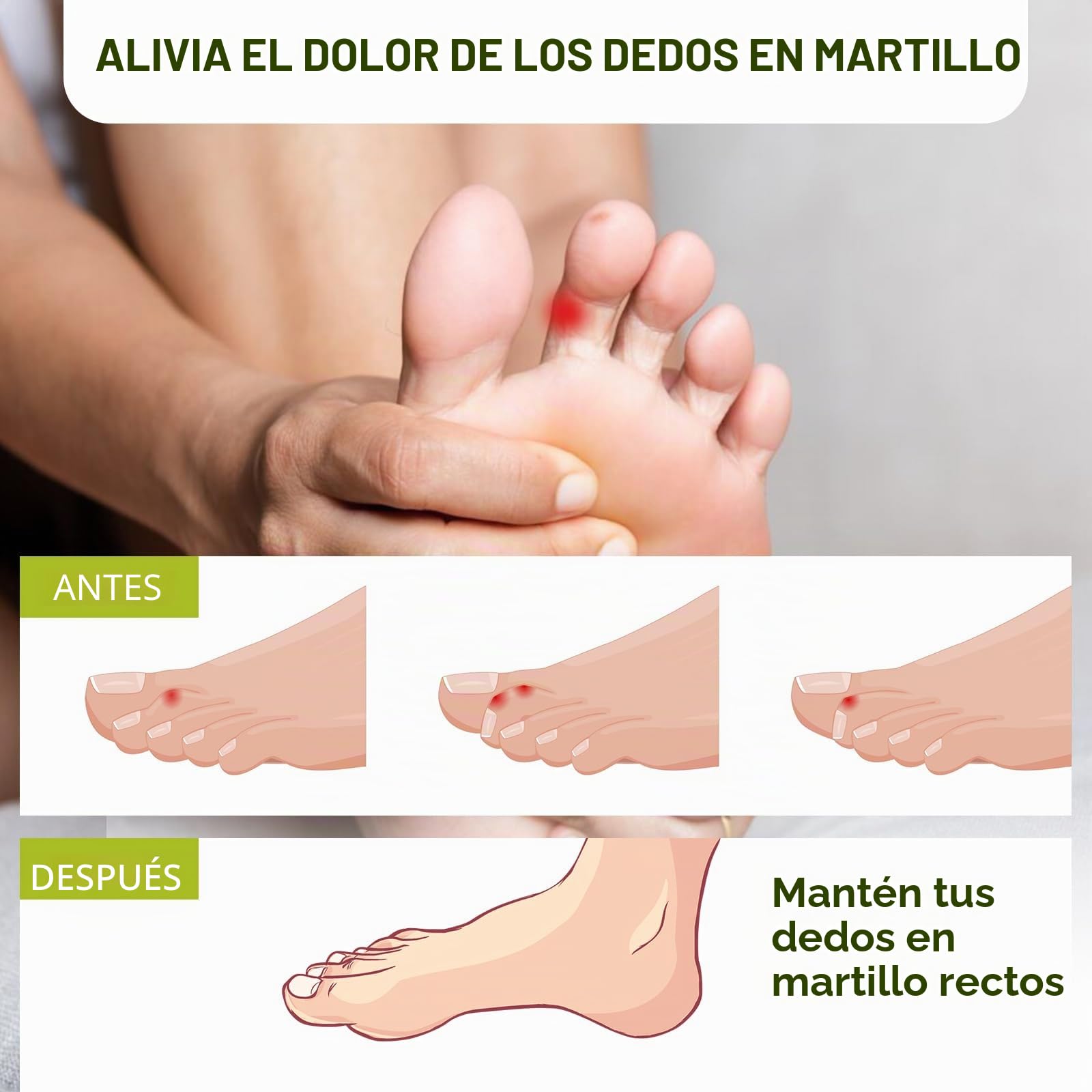 Bukihome 6 Piezas Enderezador de dedos en martillo, vendas de tela reutilizable para proteger y alisar los dedos en martillo, realinea los dedos doblados, rizados,Beige