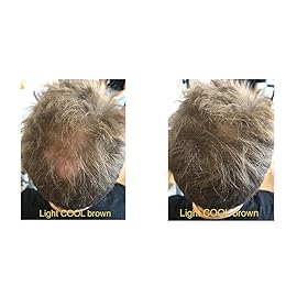 FEBRON Hair Fibers For Thinning Hair For Women & Men Hair Loss Concealer Hair Powder Volumizing Based 100% Undetectable & Natural - Bald Spots Filler (30 Gram, Light COOL Brown)