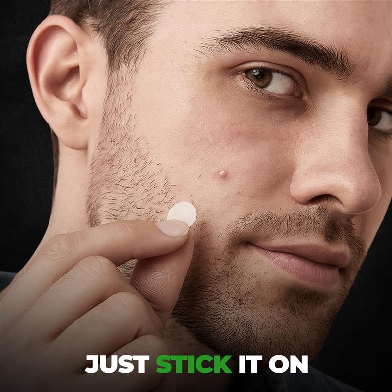 Image of Beardo Acne Pimple Patch for Face with Salicylic Acid (72 dots) | Waterproof Patches for Active Acne | Absorbs Pimple Overnight and Reduces Excess Oil | Pimple Patches for Men