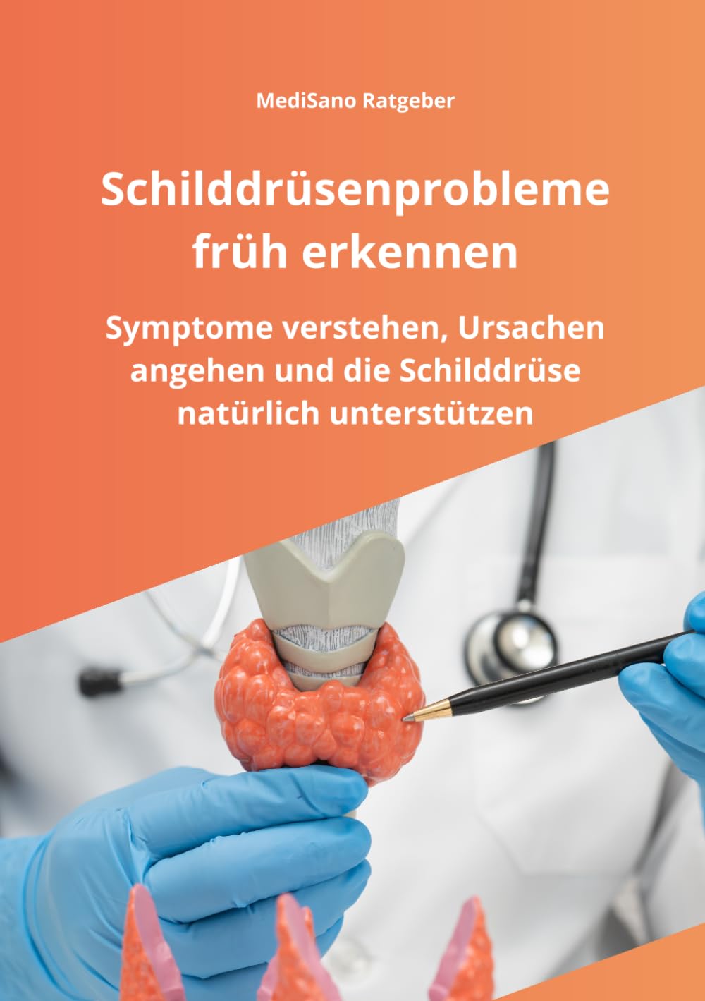 Schilddrüsenprobleme früh erkennen: Frühe Symptome erkennen, Schilddrüsenprobleme verstehen und den Stoffwechsel natürlich unterstützen - Ihr ... Energie und Wohlbefinden (MediSano Ratgeber)
