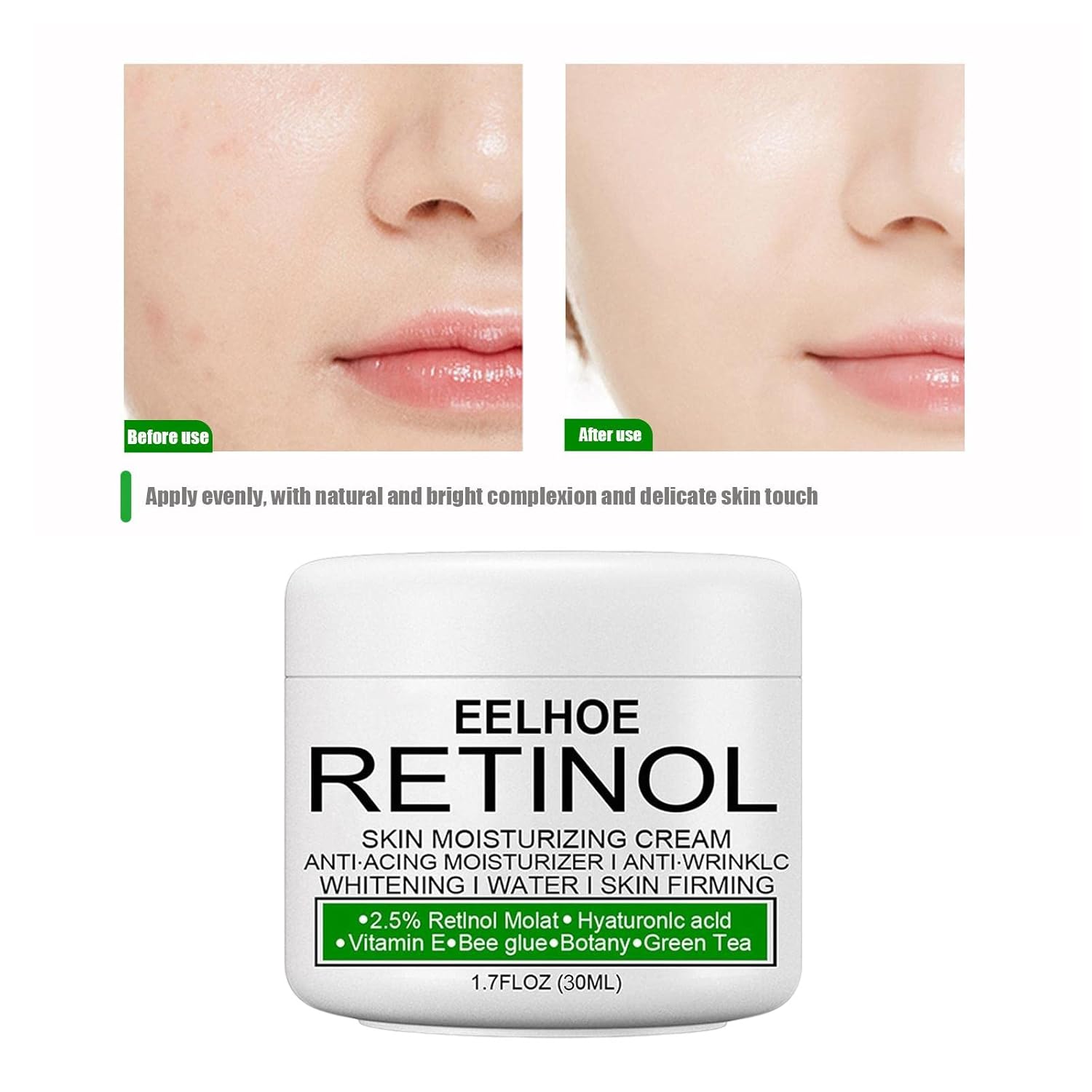 LOOM TREE Skin Moisturizing Cream Skin Care Cream Skin Lightening for Neck Elbows 30ml | Lightening Cream 7 61+PjCU5HLL. SL1500