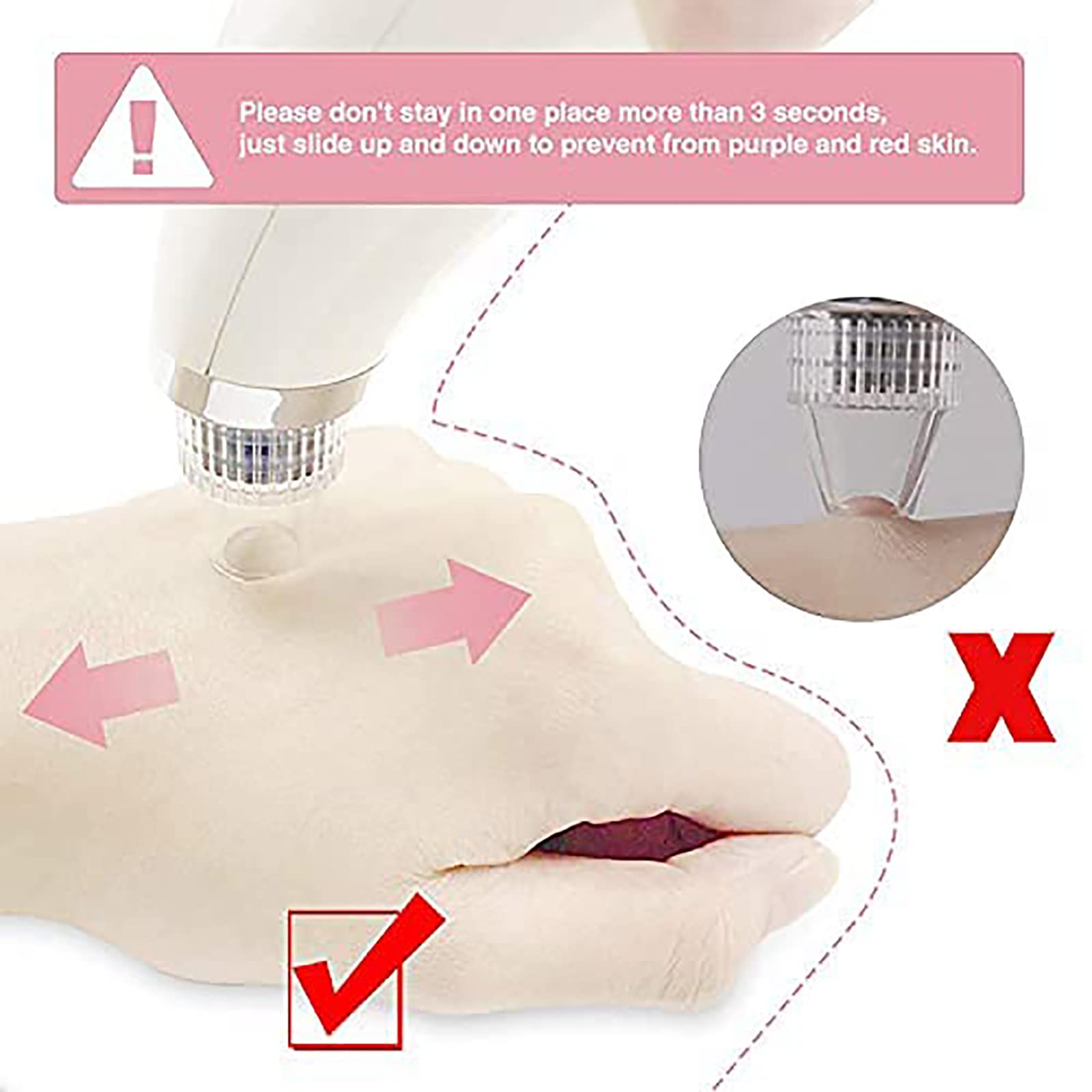 Herramienta extractora de puntos blancos para acné y comedones, extractor de espinillas de limpieza facial, limpiador de poros faciales, herramienta de succión de puntos negros, kit de extractor de