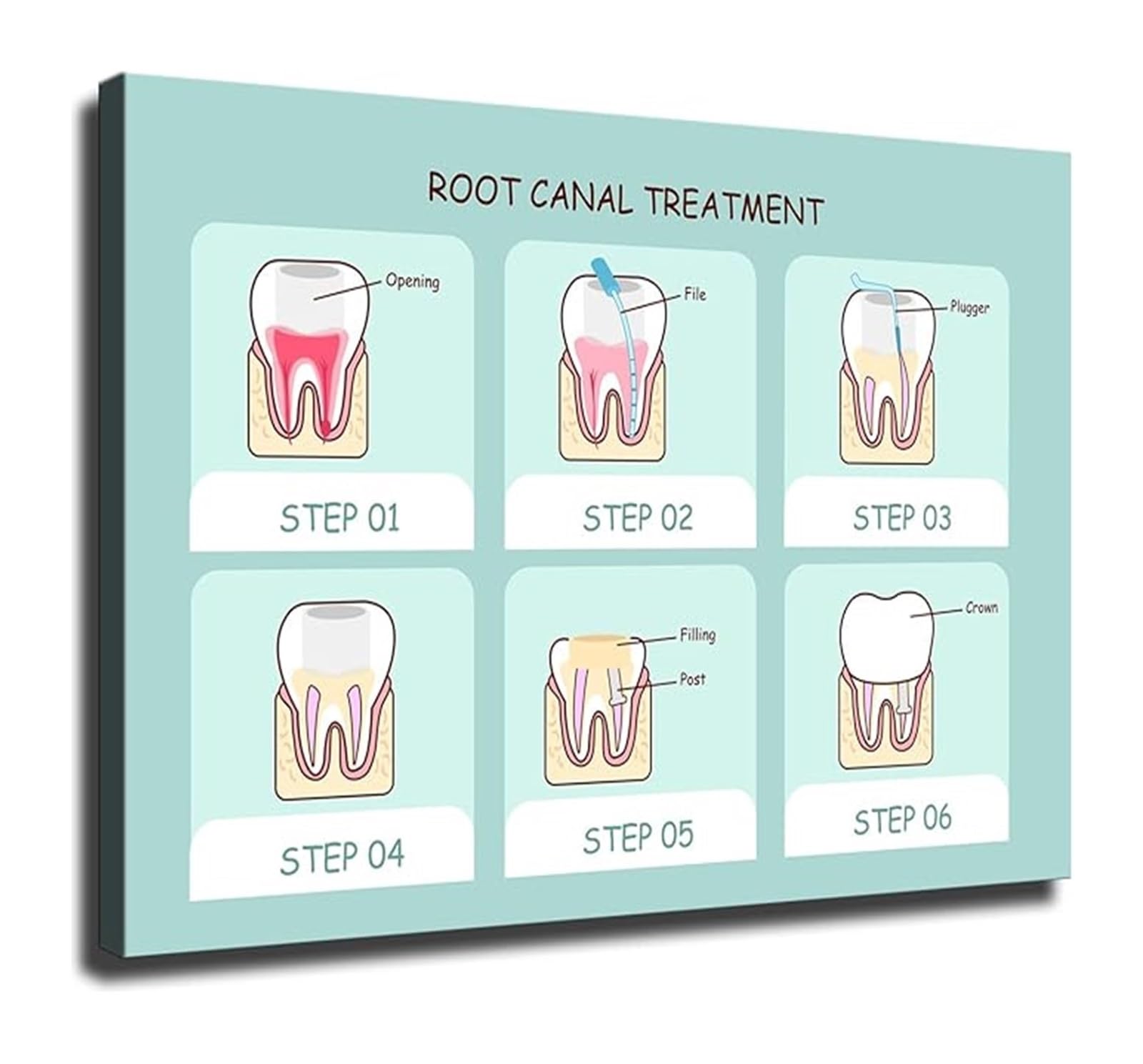 EKFBQBGW Tooth Anatomy and Health Poster Clinic Educational Chart for Office Wall Patient Info Unframed,16x24inch(40x60cm)