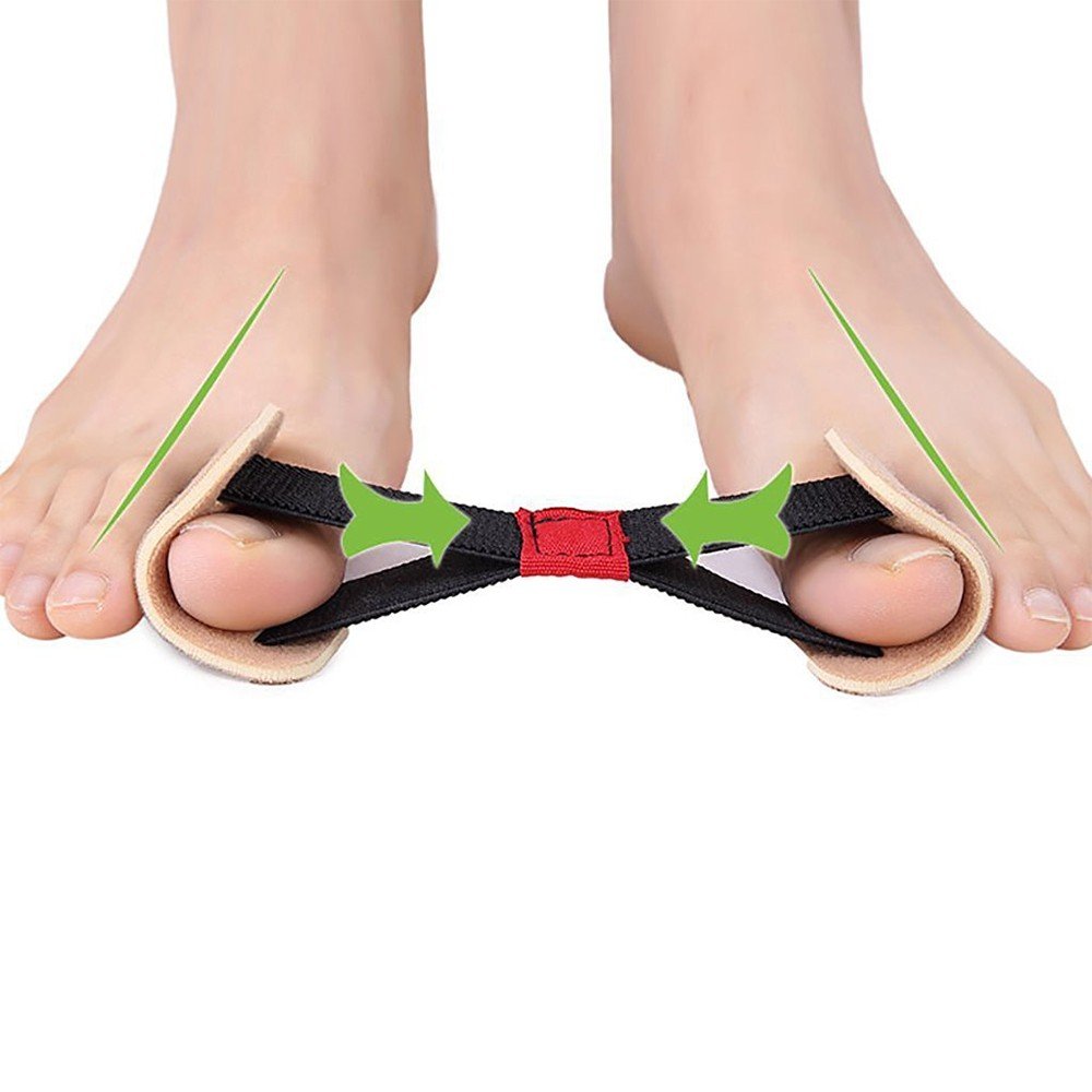 5 Fasce Elastiche Per Alluce Valgo: Correttori Con Diversi Livelli Di Resistenza, Colorate - 3