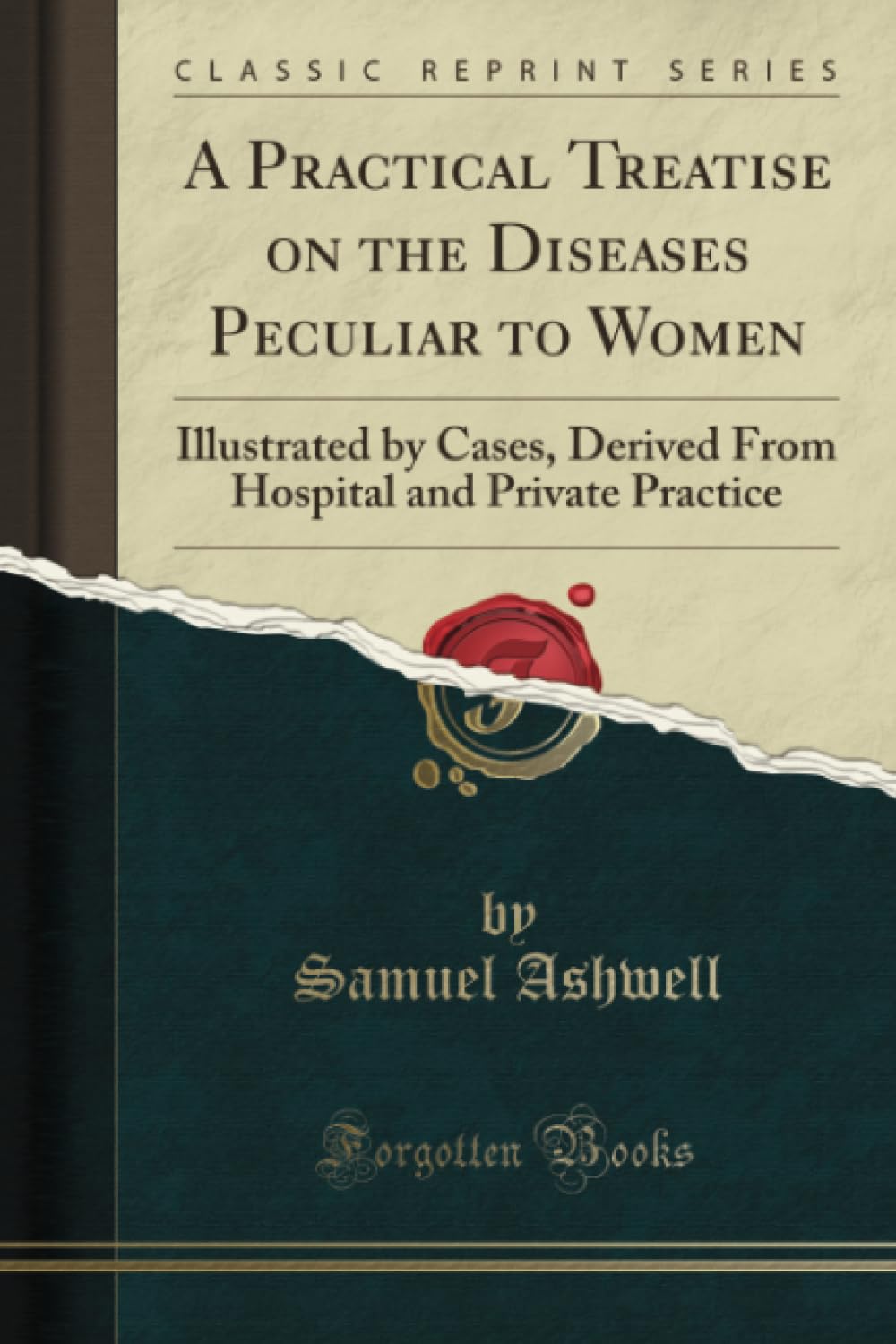 A Practical Treatise on the Diseases Peculiar to Women (Classic Reprint): Illustrated by Cases, Derived From Hospital and Private Practice: ... and Private Practice (Classic Reprint)