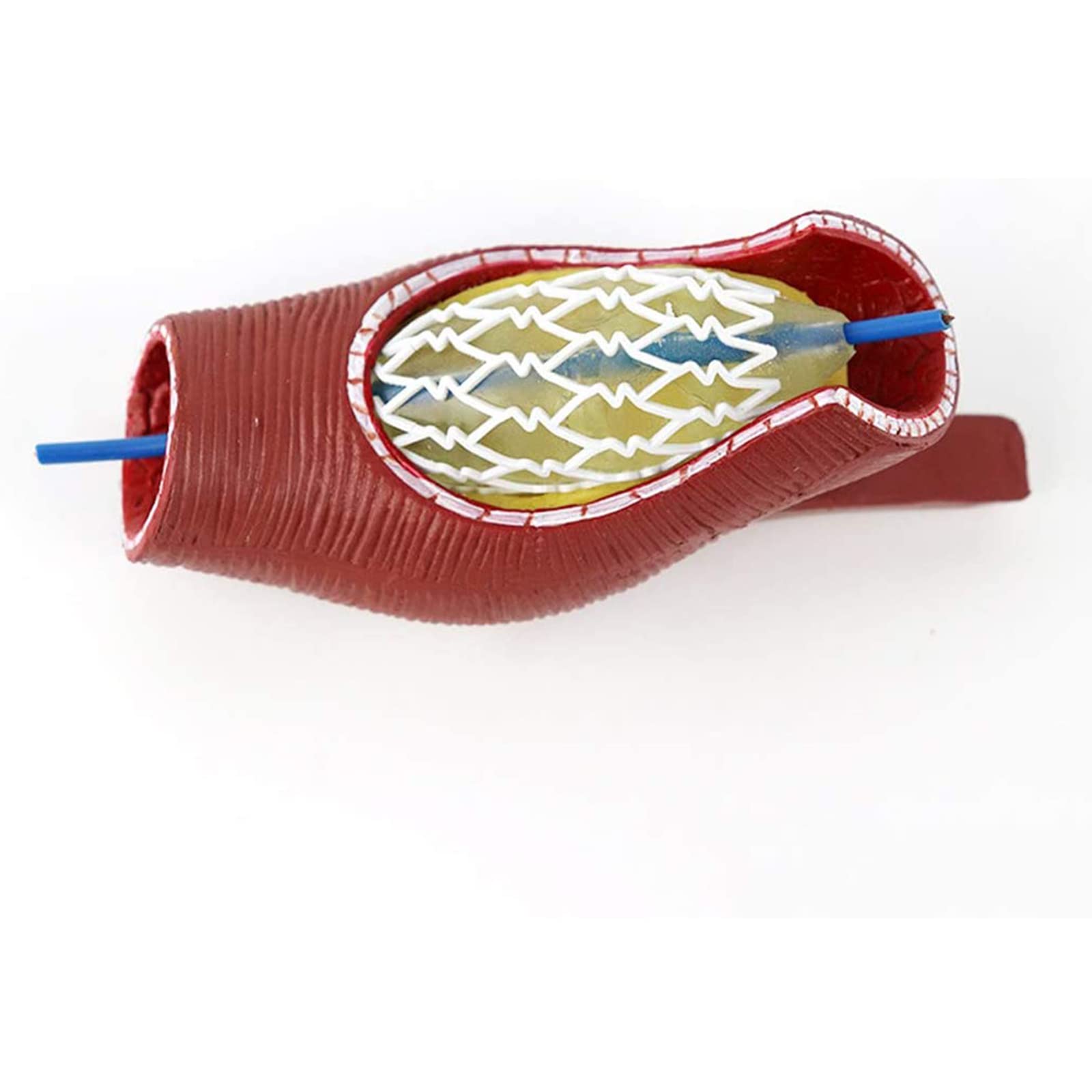 Modello di Blocco dei vasi sanguigni del Cuore e del Cervello Umano, Modello anatomico dello Stent del Corpo Umano per la dimostrazione di Modelli di Anatomia scientifica