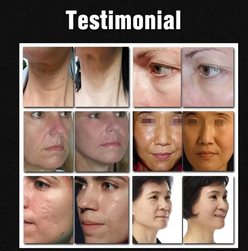 Mecavie Professional Full Body & Face Beauty Device,4 Microcrystalline Heads, Enhances Firmness, Reduces Lines & Improves Skin Texture for Salon Use