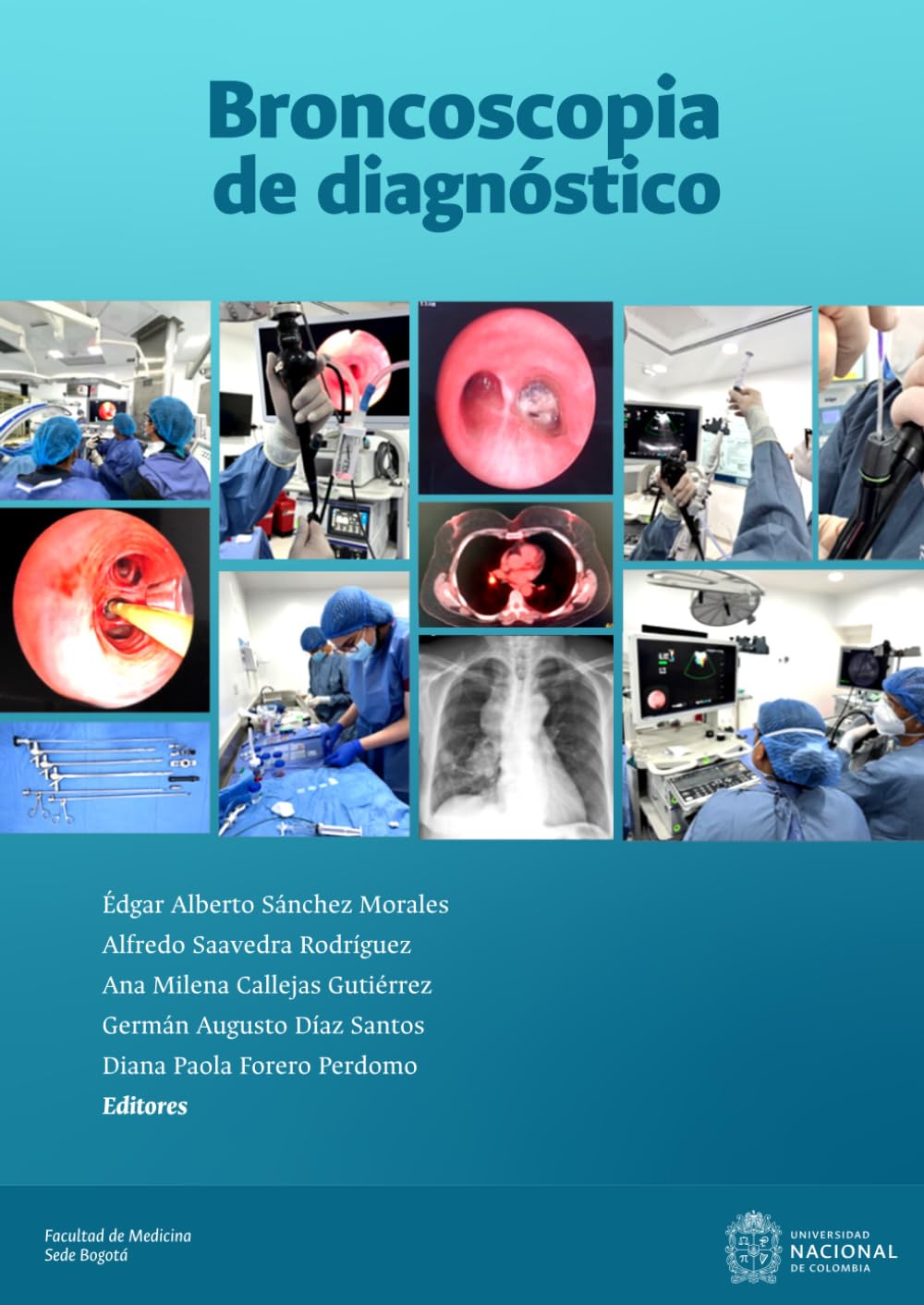 Broncoscopia de diagnóstico