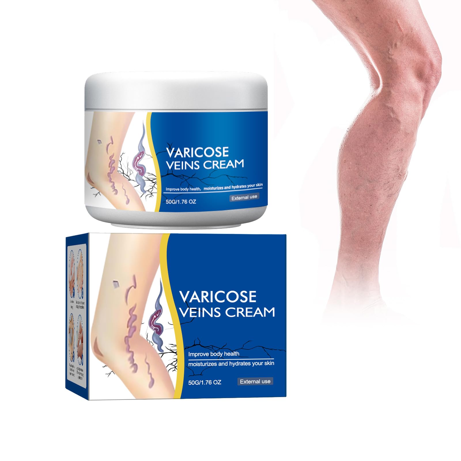 Varicose Veins Cream, Beinpflegebalsam – Creme Gegen Besenreiser, Krampfadern und Besenreiser Entfernen, Natürliche Beinpflege, Verbessert Durchblutung, Pflegt und Beruhigt Müde Beine