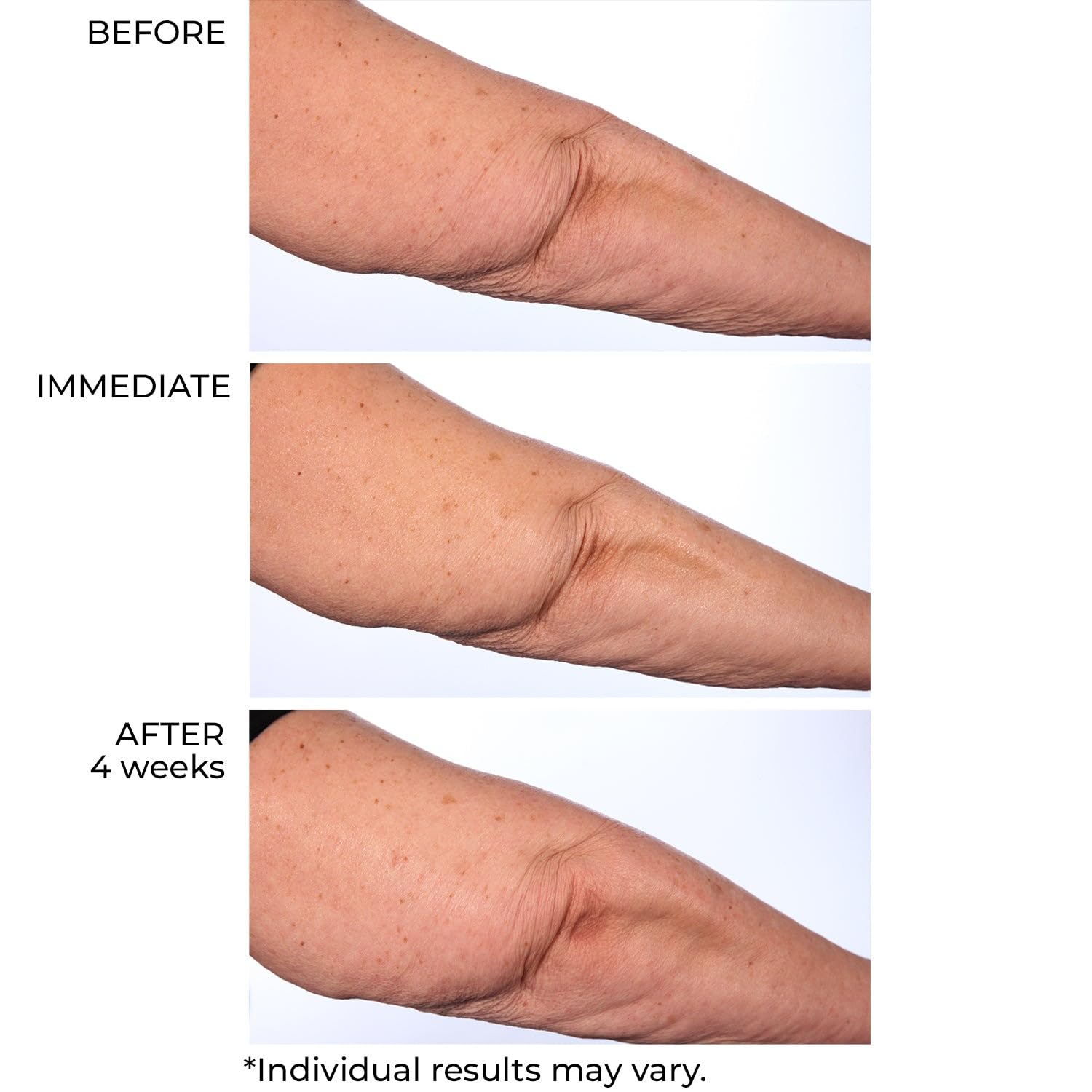 NassifMD Hydro-Screen Intense Hydration Face And Body Souffle