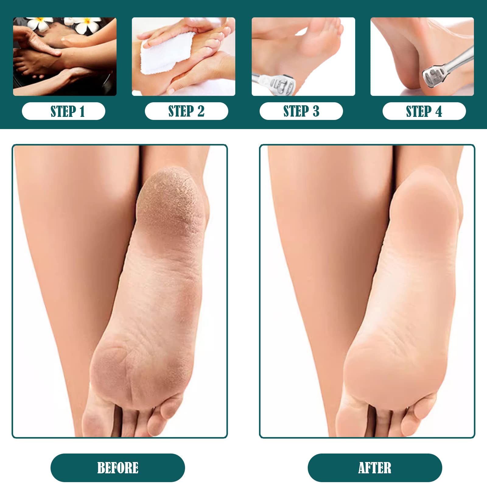 14 Piezas Pedicura Lima para pies, Profesional Raspador lima, Rascador de pies con 10 Cuchillas, para Escofina Removedor de Callos Pedicura