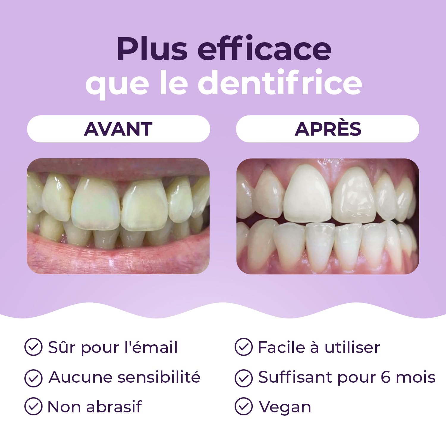 Poudre de blanchiment des dents Onlysmile pour dents blanches | Blanchiment dentaire professionnel | Effet nettoyant visible | Blanchisseur de dents sûr et indolore - Nettoyage cosmétique des dents