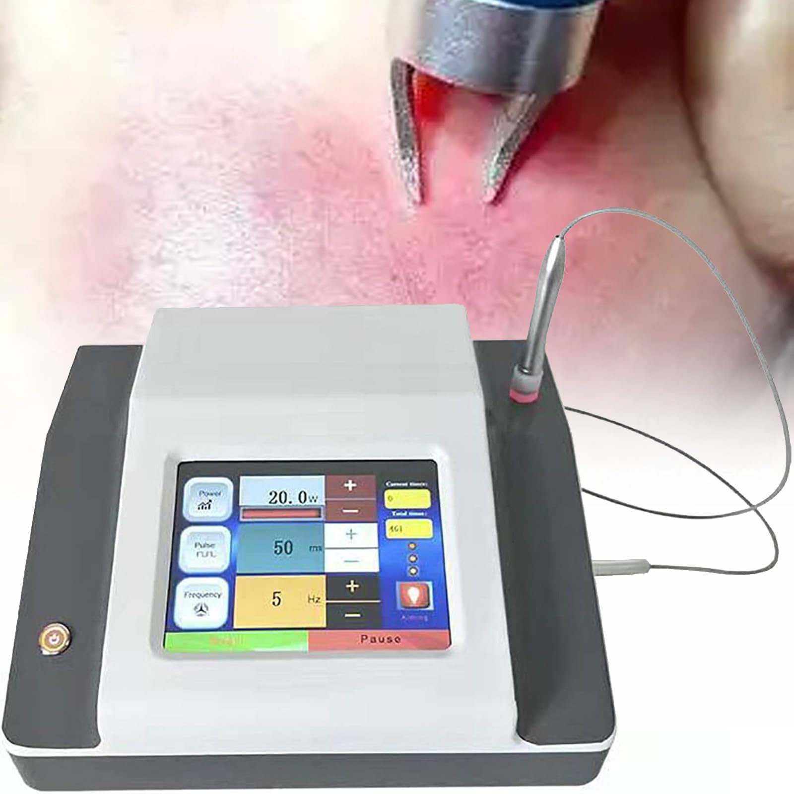 JIADUOFU Spider Varicose Vein Treatment Device, Remove Facial Thread Veins Red Blood Vessel Spots, High Frequency Spider Veins Removal Device, Vascular Removal Beauty Equipment for Face, Nose