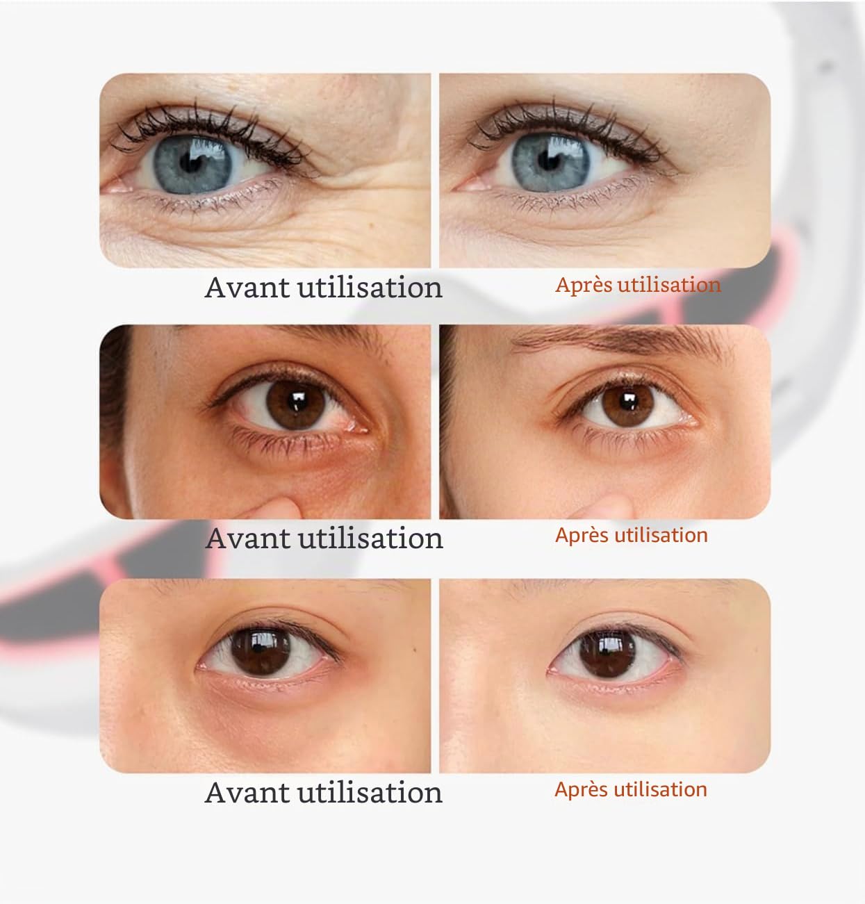 EyeLift Lunettes de thérapie par lumière rouge avec masseur à micro-courants, rechargeables, noires, pour cernes, gonflements, rides et poches sous les yeux