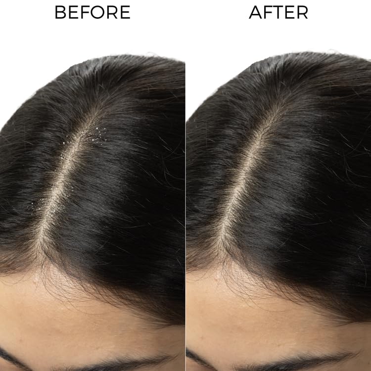 Image of Brillare Tea Tree Anti Dandruff Shampoo - 200ml