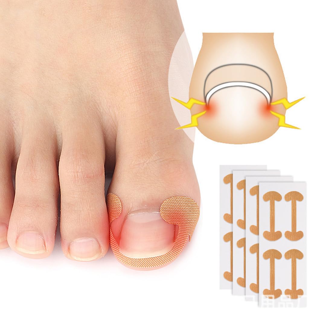 50 Foglio Correttore per Unghie Incarnite, Cerotti per Unghie, Unghia Incarnita Alluce, Unghie Incarnite Piedi, Strumenti per Pedicure, Cerotto per Unghia Incarnita