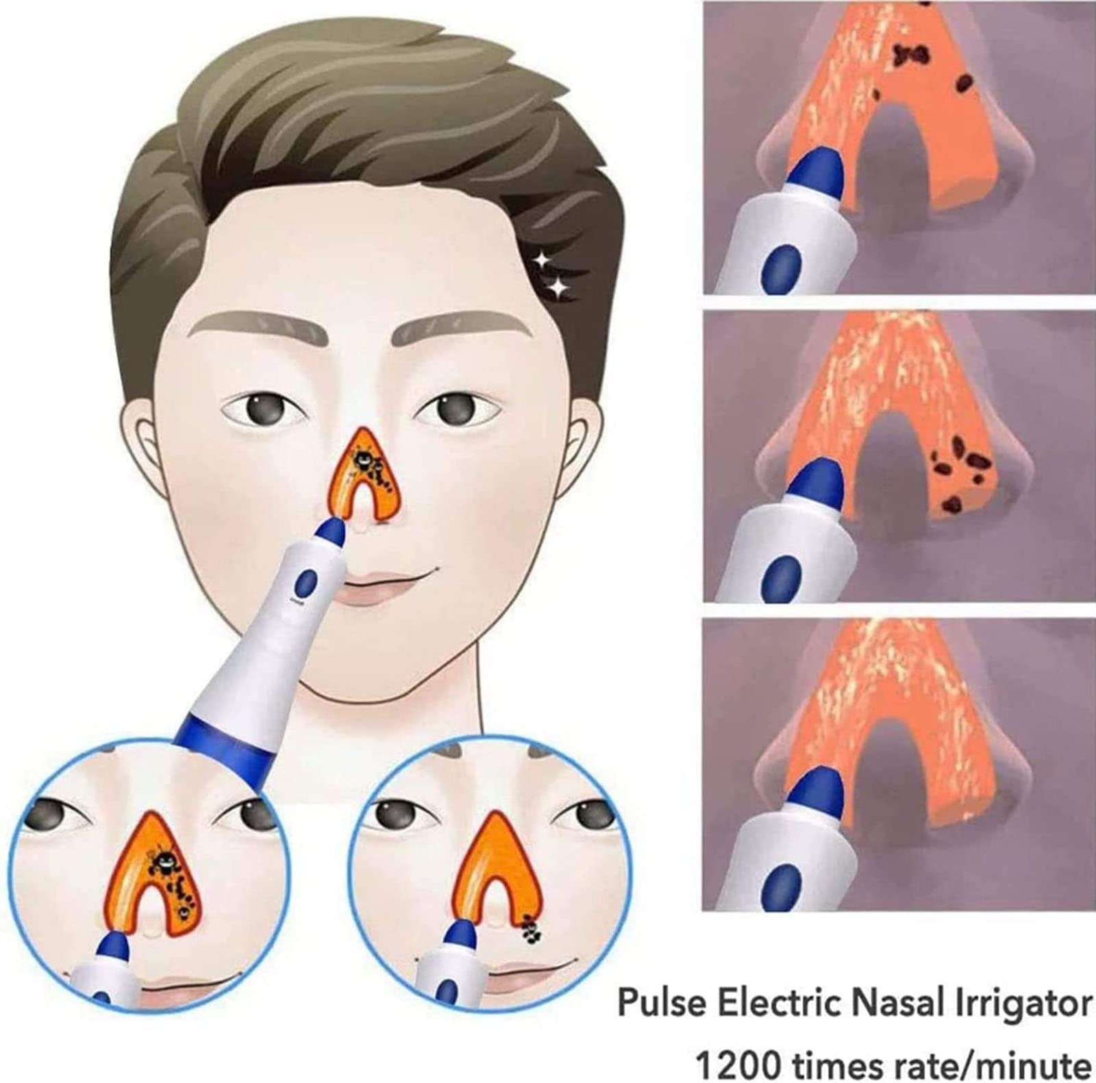 CEEBUS Irrigador Nasal eléctrico Máquina de Limpieza de Nariz portátil Limpiador de Lavado Nasal de 300 ml con Dos Picos para Adultos Niños Prevenir la rinitis alérgica Olla Enjuague Nasal